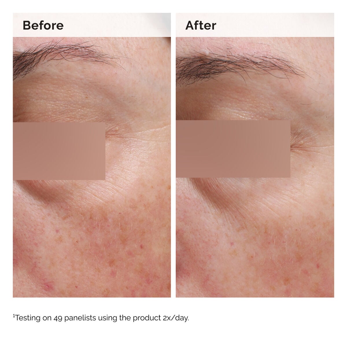 niacinamide-5-face-and-body-emulsion-t7 2024-08-23-ORD-Nia-5pct-Face-Body-B-A-Elasticity-Global-02-1x1.jpg