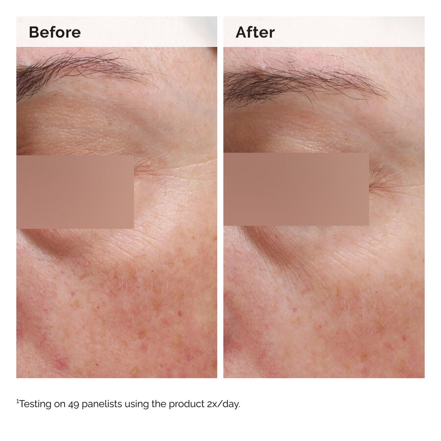 niacinamide-5-face-and-body-emulsion-t7 2024-08-23-ORD-Nia-5pct-Face-Body-B-A-Elasticity-Global-02-1x1.jpg
