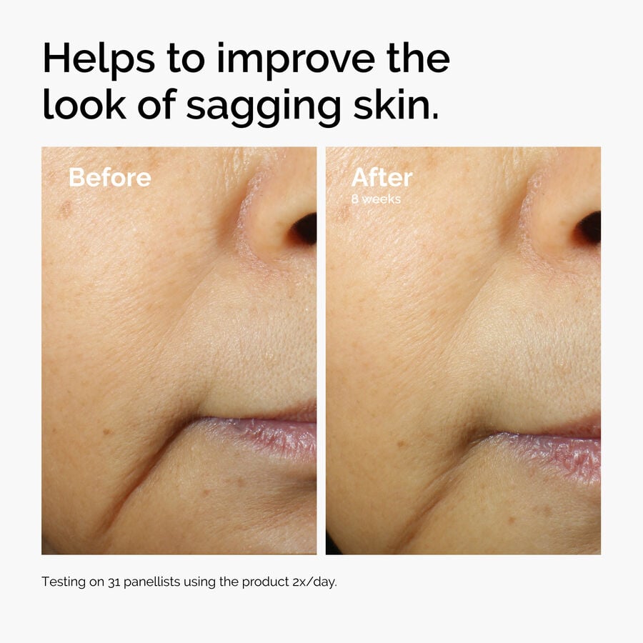 caffeine-3-escin-1-face-serum-f5 ord-caffeine-3pct-escin-1pct-face-serum-before-after-sagging.jpg