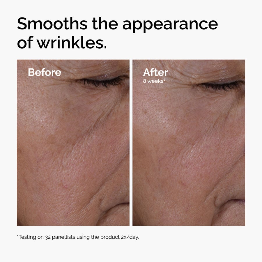 multi-peptide-ha-serum-f4 ord-multi-peptide-ha-serum-wrinkles-before-after.jpg
