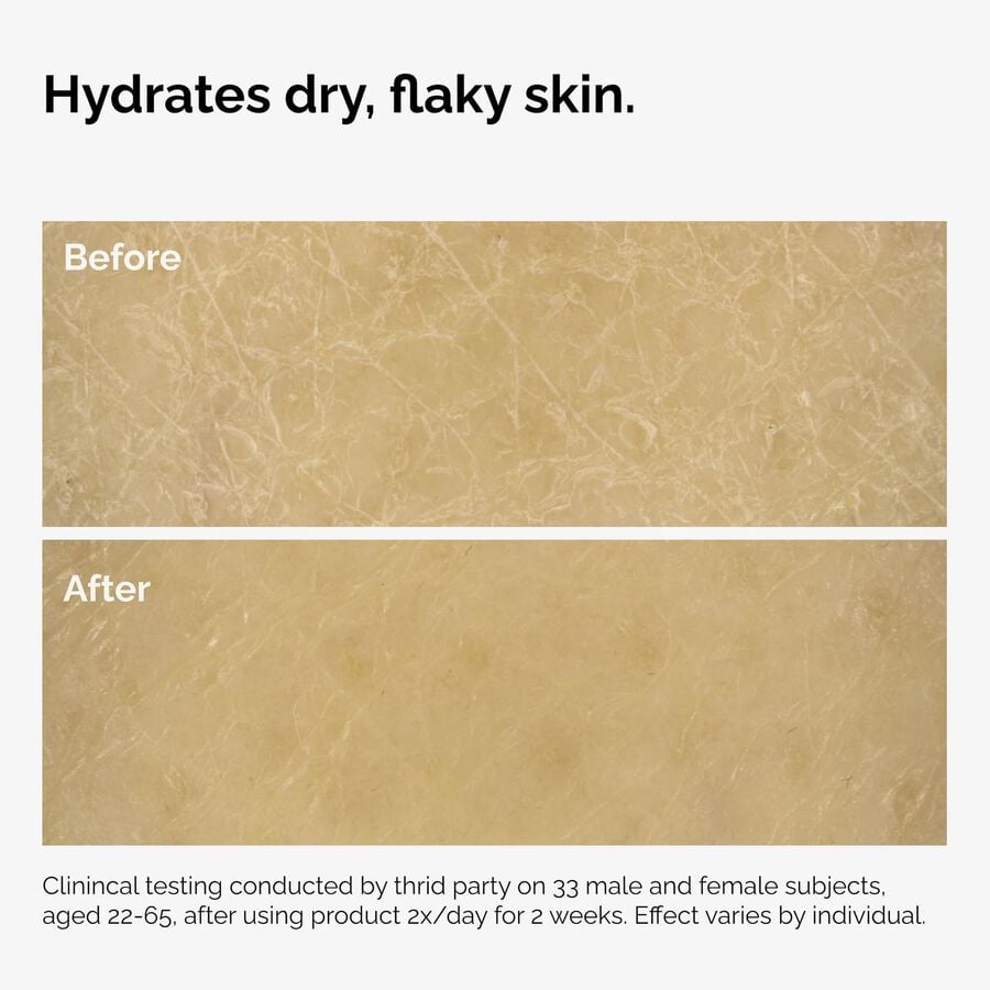 the-body-care-collection-z2 ord-natural-moisturizing-factors-inulin-body-before-after-graphic-02.jpg