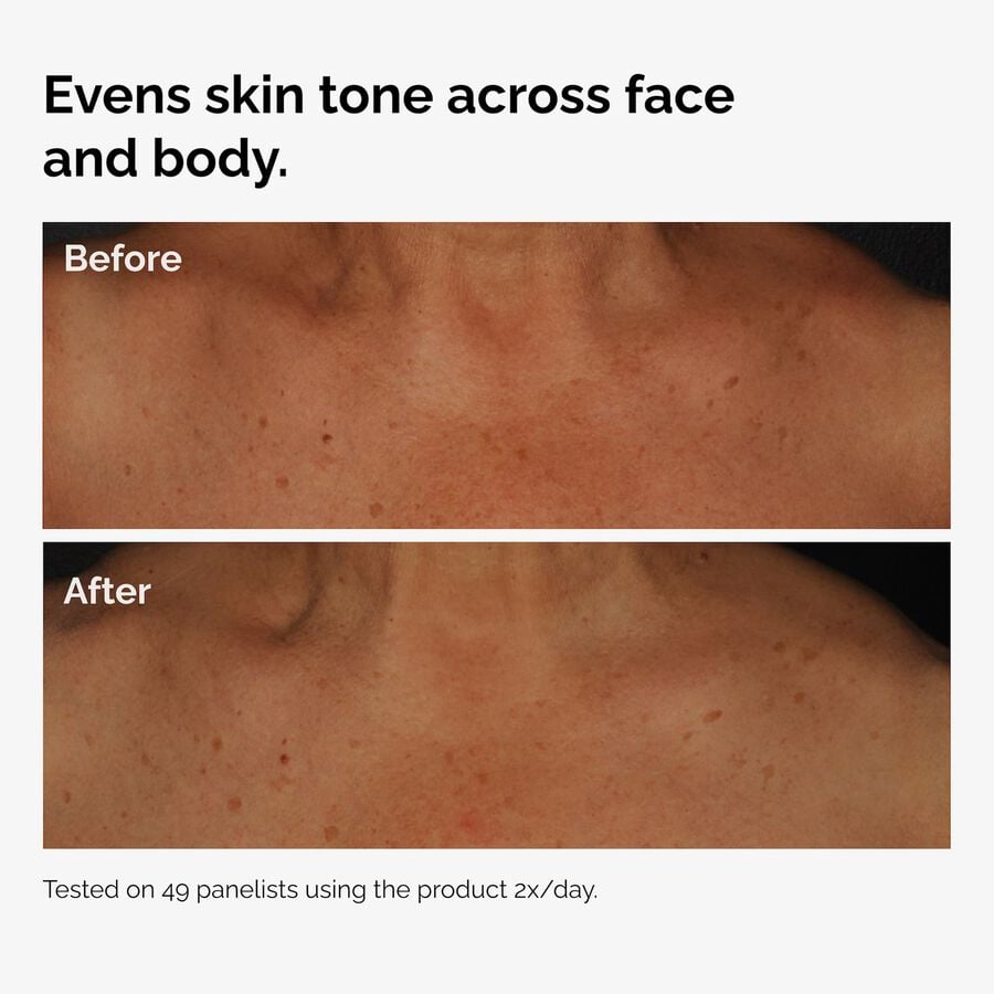 the-body-care-collection-z2 ord-niacinamide-face-body-serum-before-after-even-tone-graphic.jpg