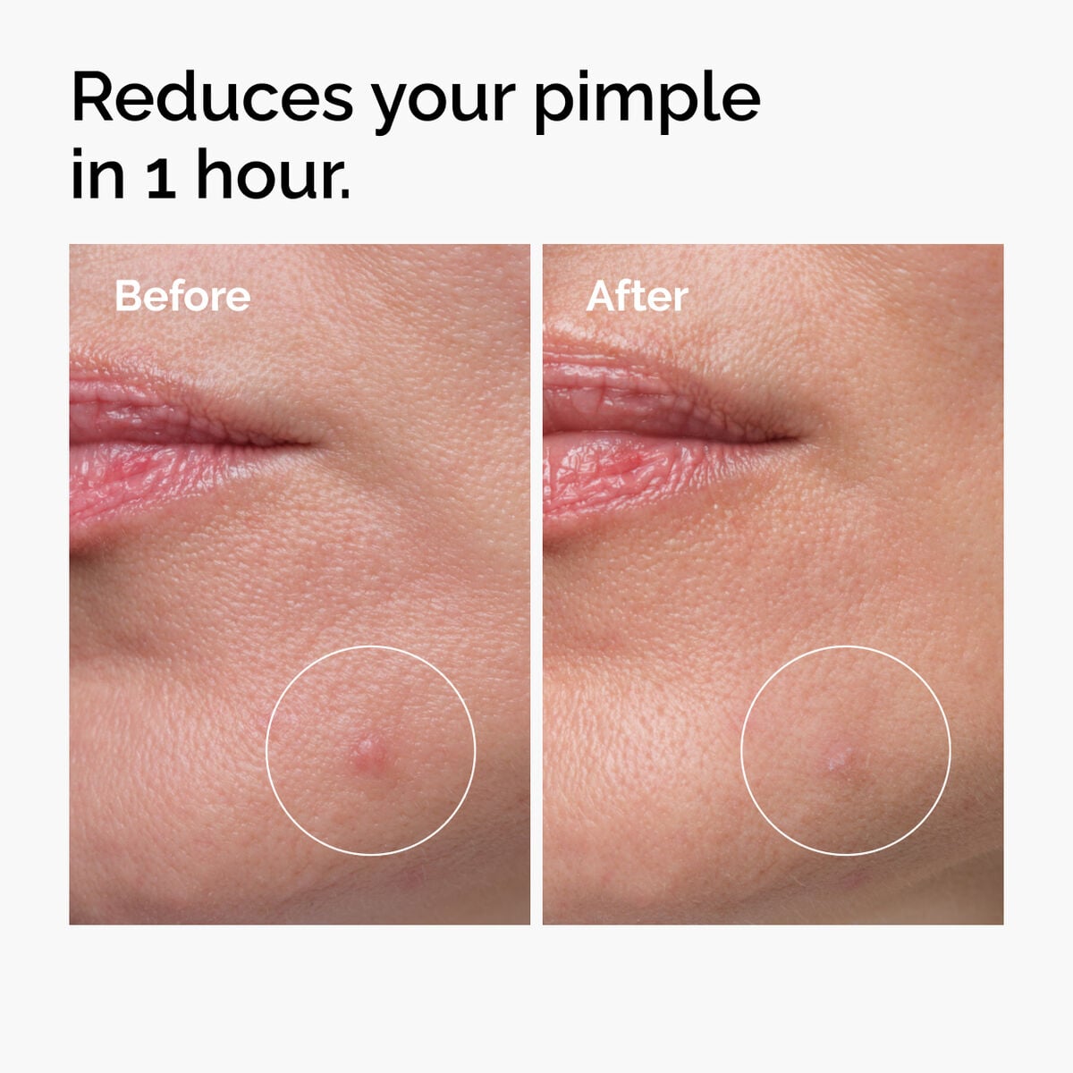 sulfur-10-powder-to-cream-concentrate-s0 ord-sulfur-10pct-powder-to-cream-concentrate-before-after-NA.jpg